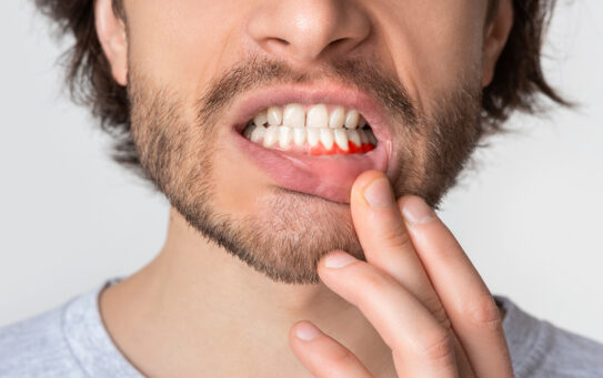 ¿Cuál es el origen y el tratamiento del sangrado gingival?